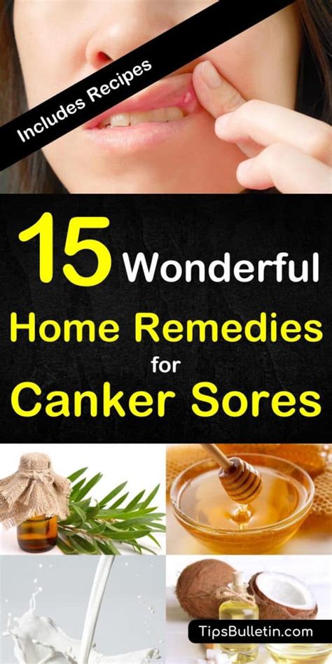 How To Get Rid Of Canker Sores: 18 Fast Remedies.